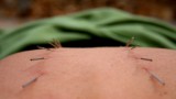 Needles to Ready the Body for a Baby